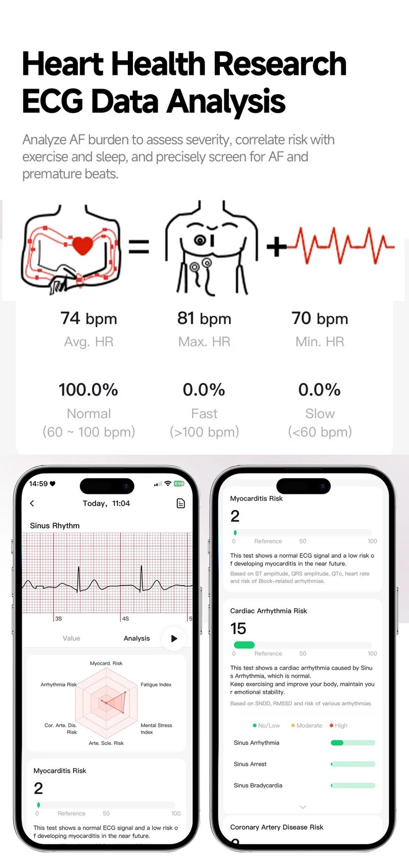ET493 AMOLED Health Smart Watch - detail 04