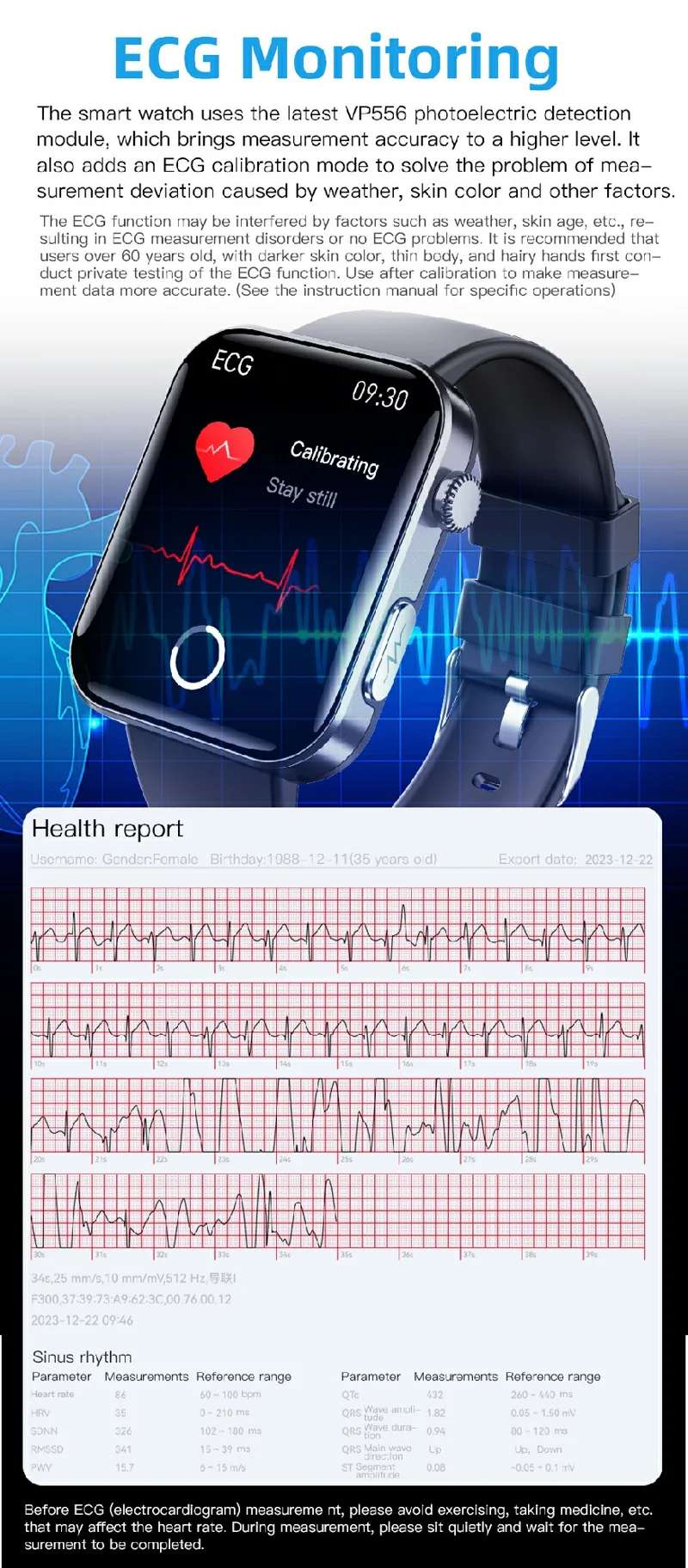 F300 HD Calling Smart Watch - detail 03