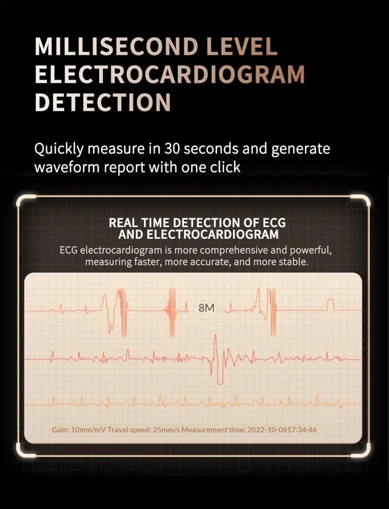 U21 ECG Health Smart Watch - detail 07